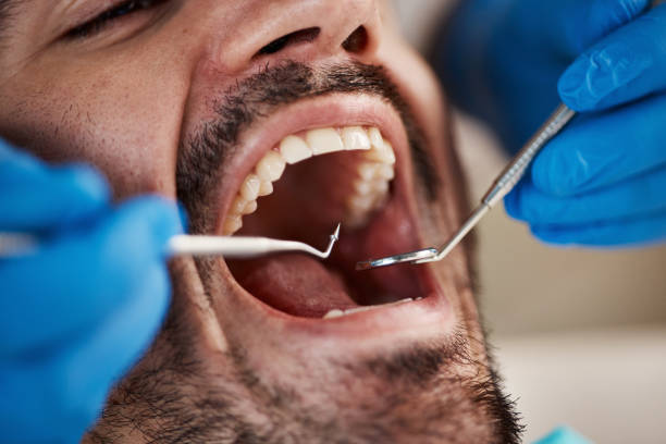 Best Cosmetic Emergency Dentistry in Mount Hermon, CA