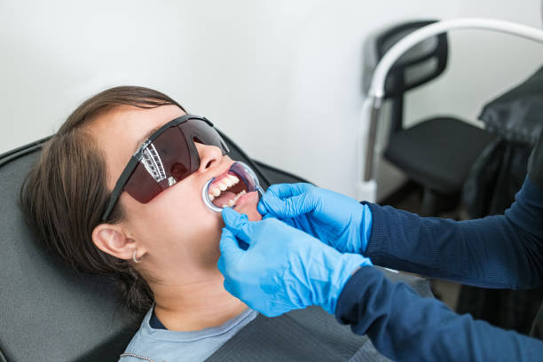 Best Emergency Wisdom Teeth Removal in Mount Hermon, CA