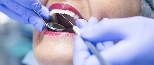 Best Pediatric Emergency Dentist in Mount Hermon, CA